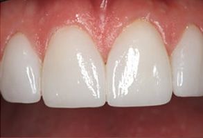 Finesse Dental Care