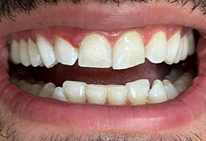 Finesse Dental Care