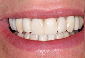 Finesse Dental Care