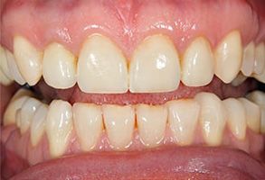 Finesse Dental Care