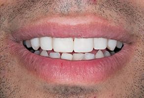 Finesse Dental Care