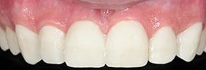 Finesse Dental Care