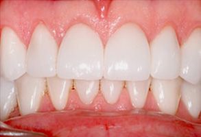 Finesse Dental Care
