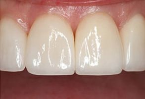 Finesse Dental Care
