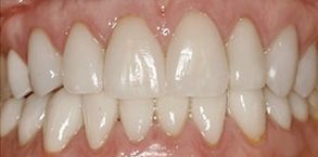 Finesse Dental Care