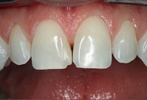 Finesse Dental Care