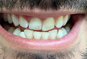 Finesse Dental Care