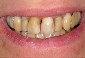 Finesse Dental Care