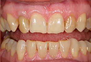 Finesse Dental Care