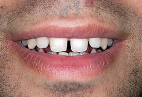 Finesse Dental Care