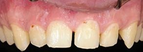 Finesse Dental Care