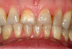 Finesse Dental Care