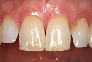 Finesse Dental Care