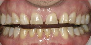 Finesse Dental Care