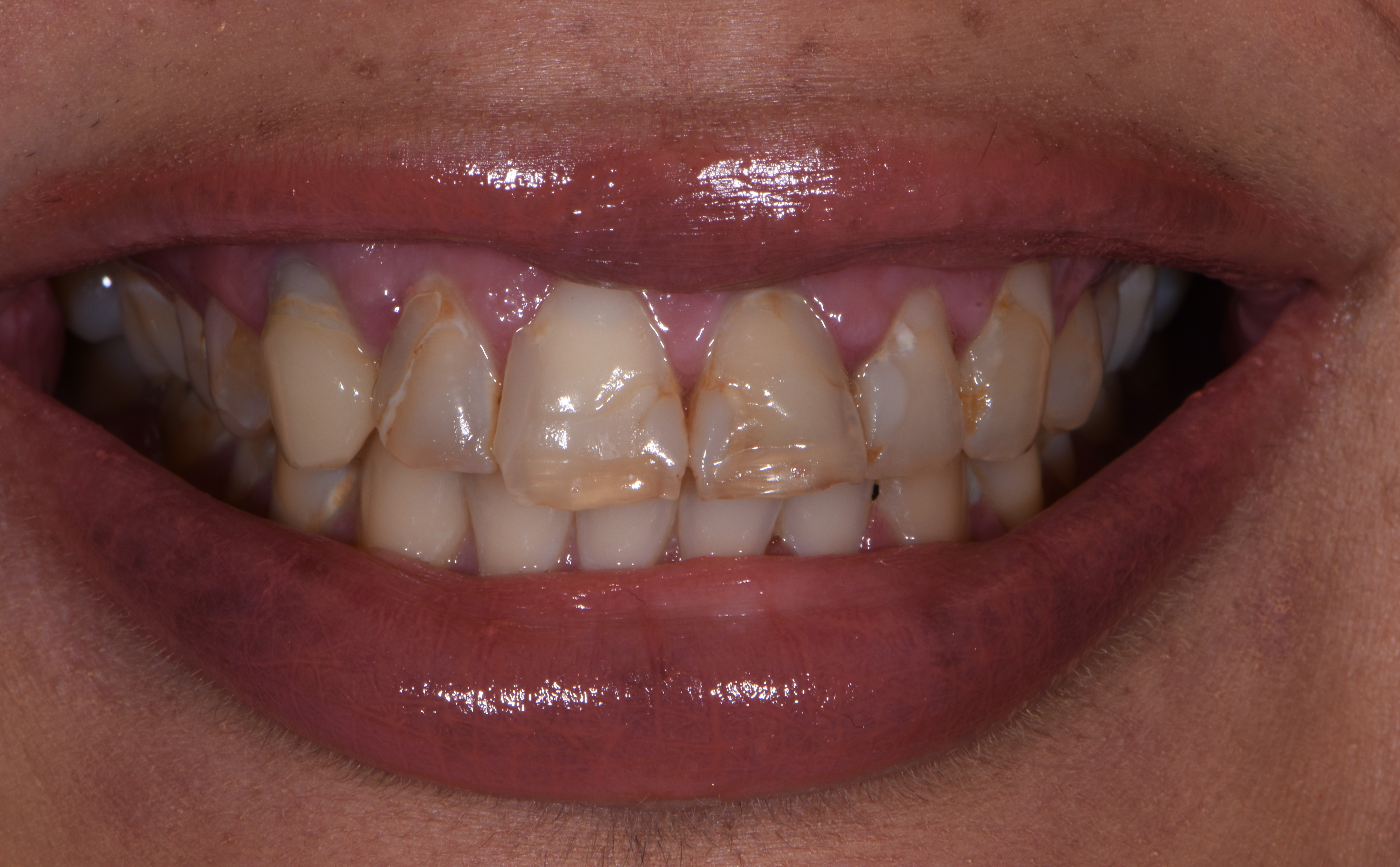 Finesse Dental Care