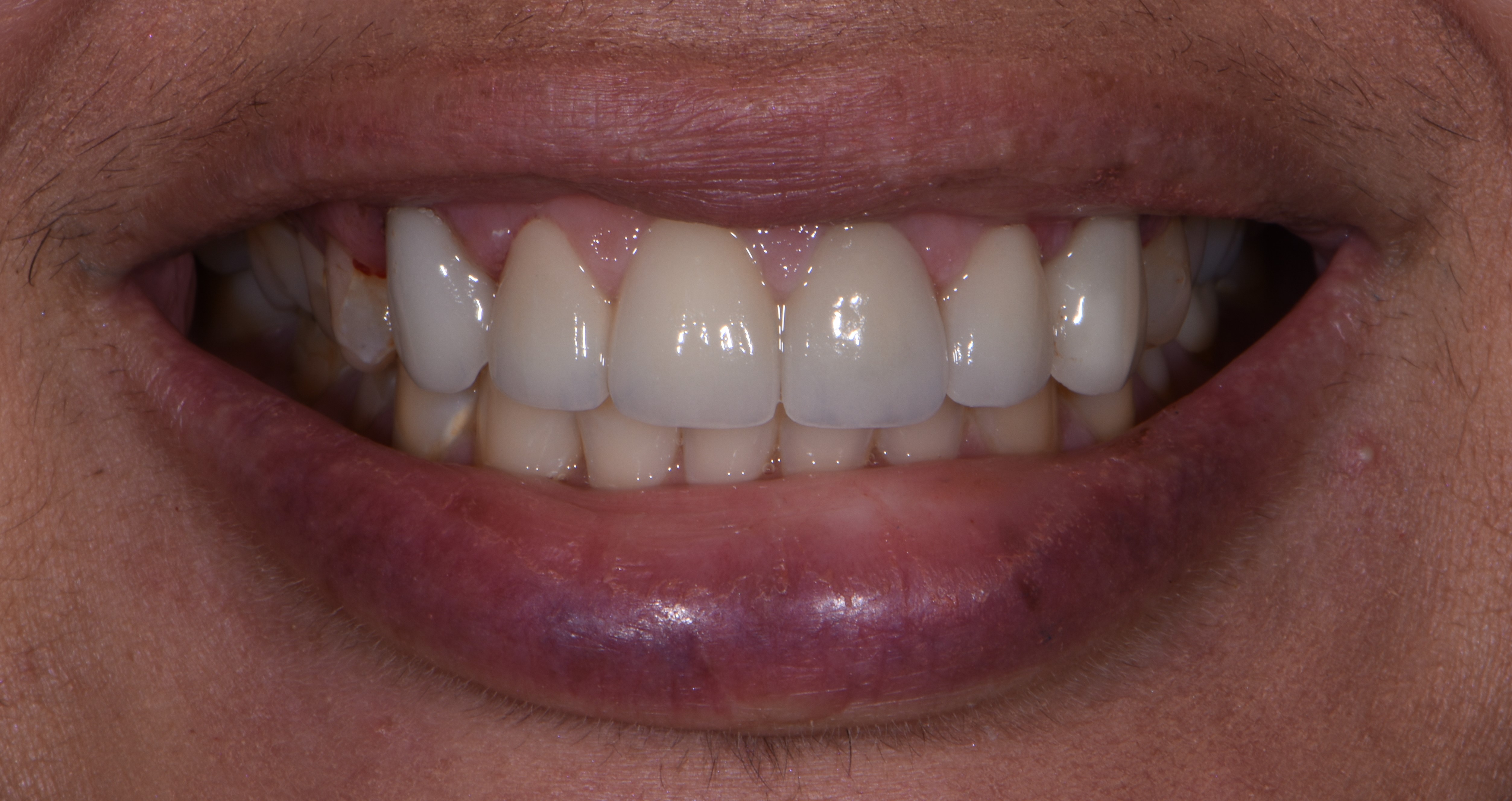 Finesse Dental Care