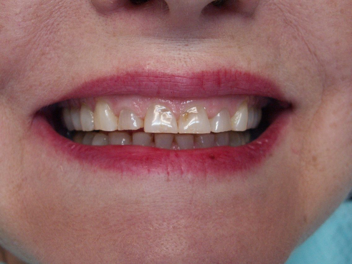 Finesse Dental Care
