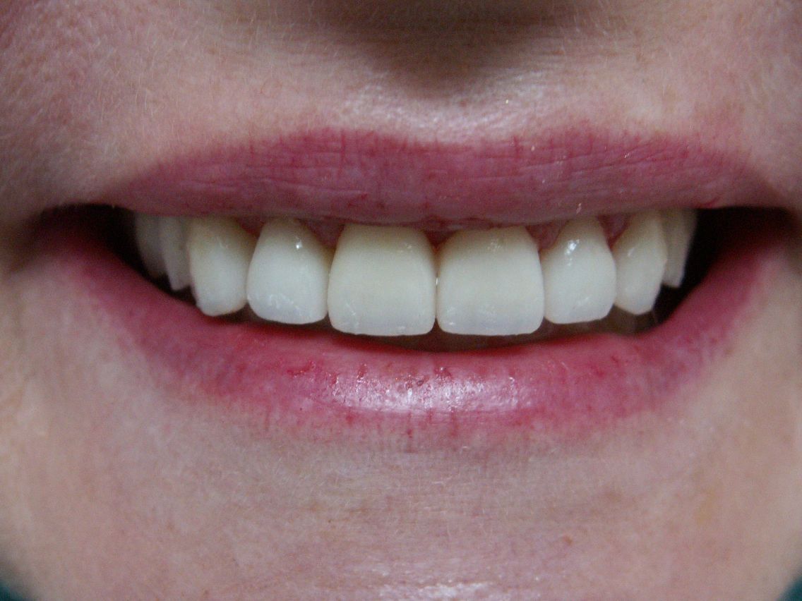 Finesse Dental Care
