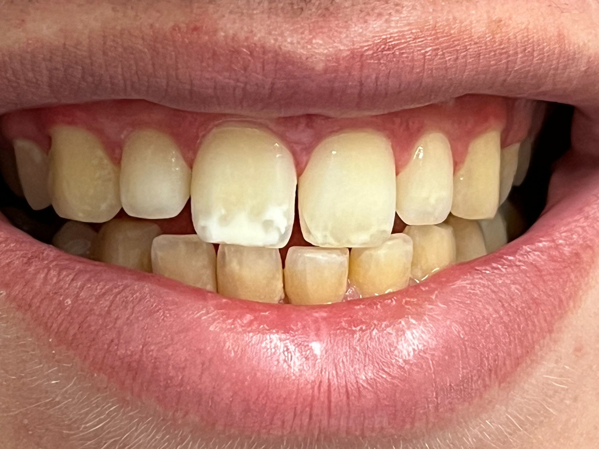 Finesse Dental Care