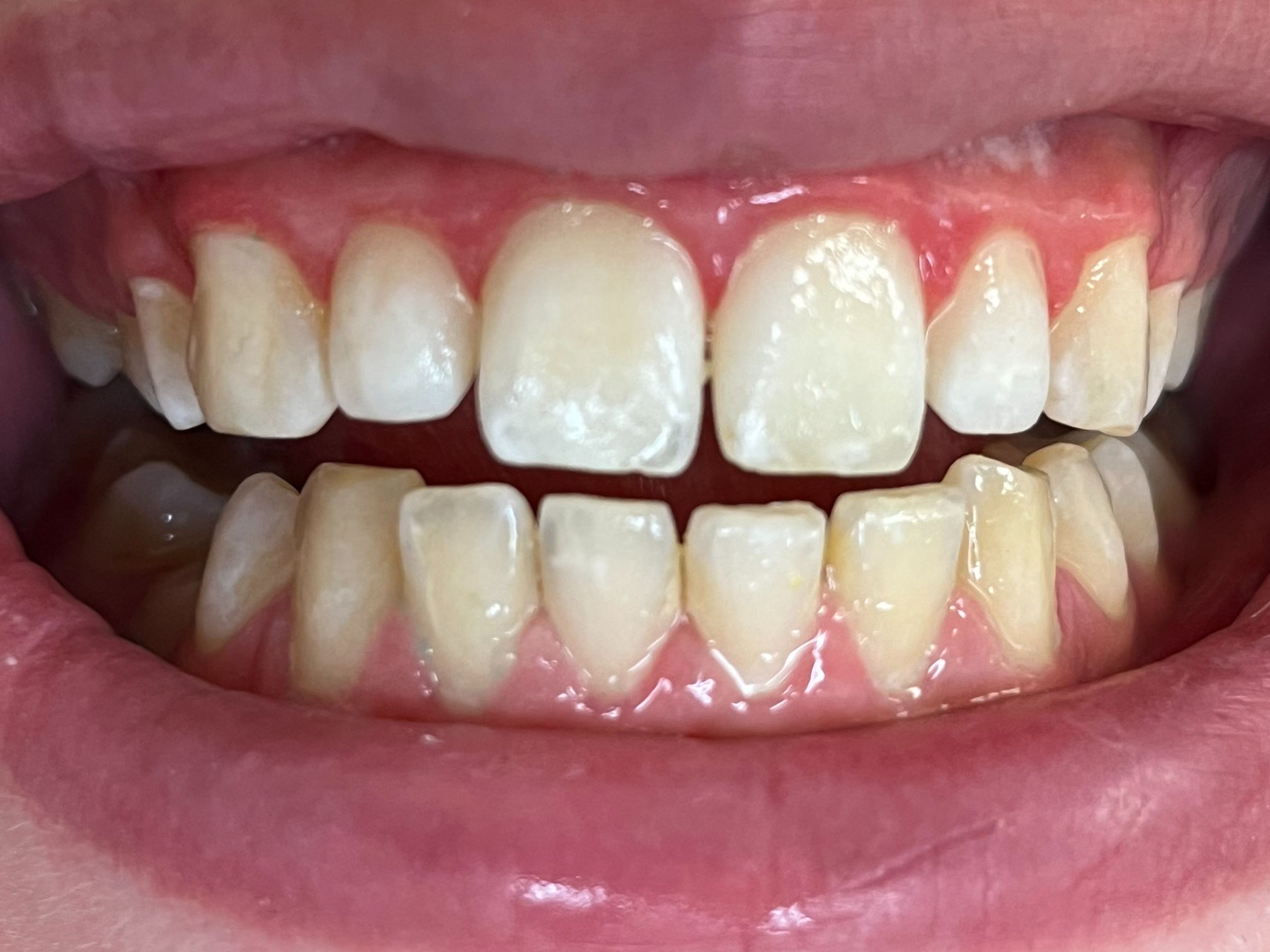 Finesse Dental Care