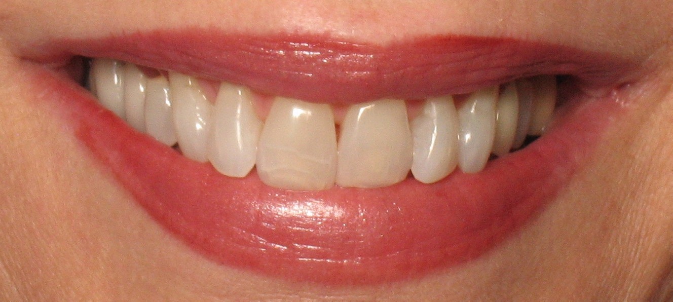 Finesse Dental Care