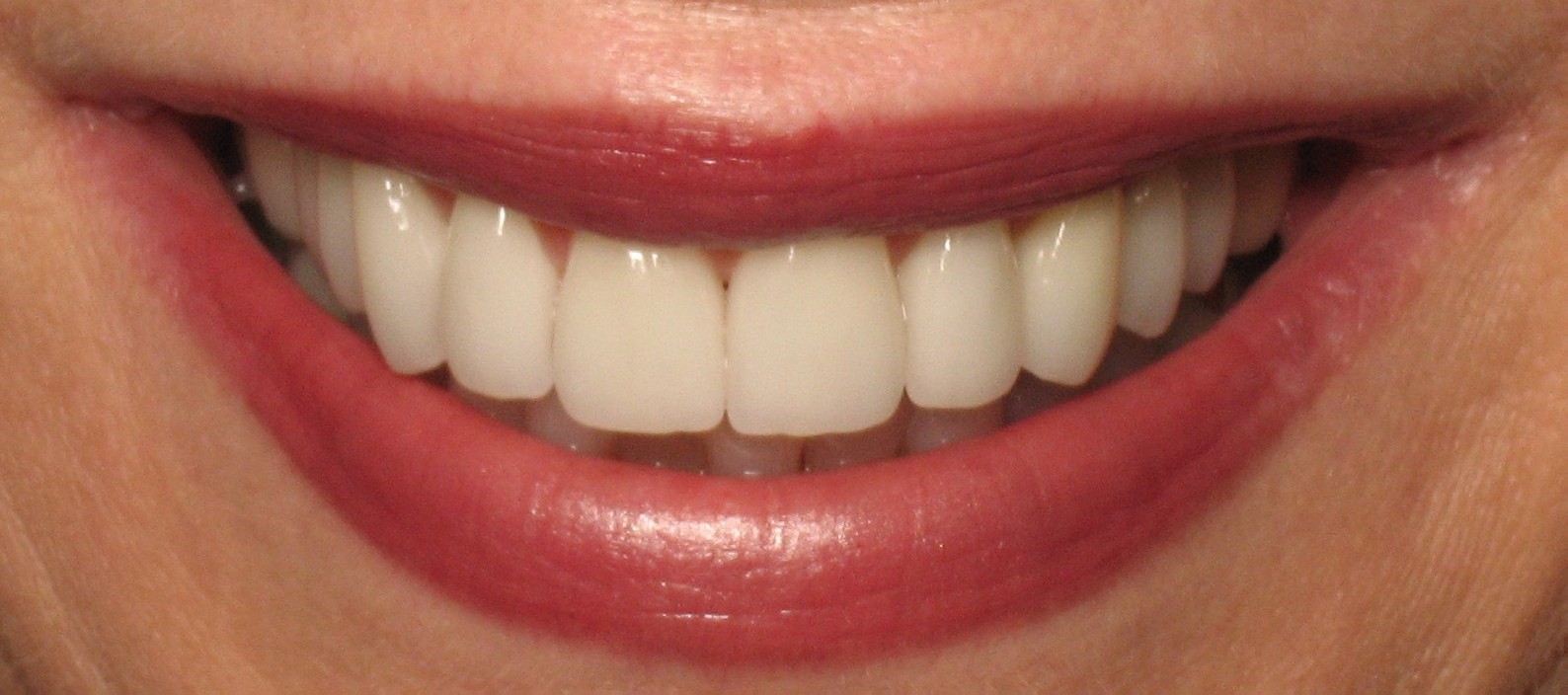 Finesse Dental Care