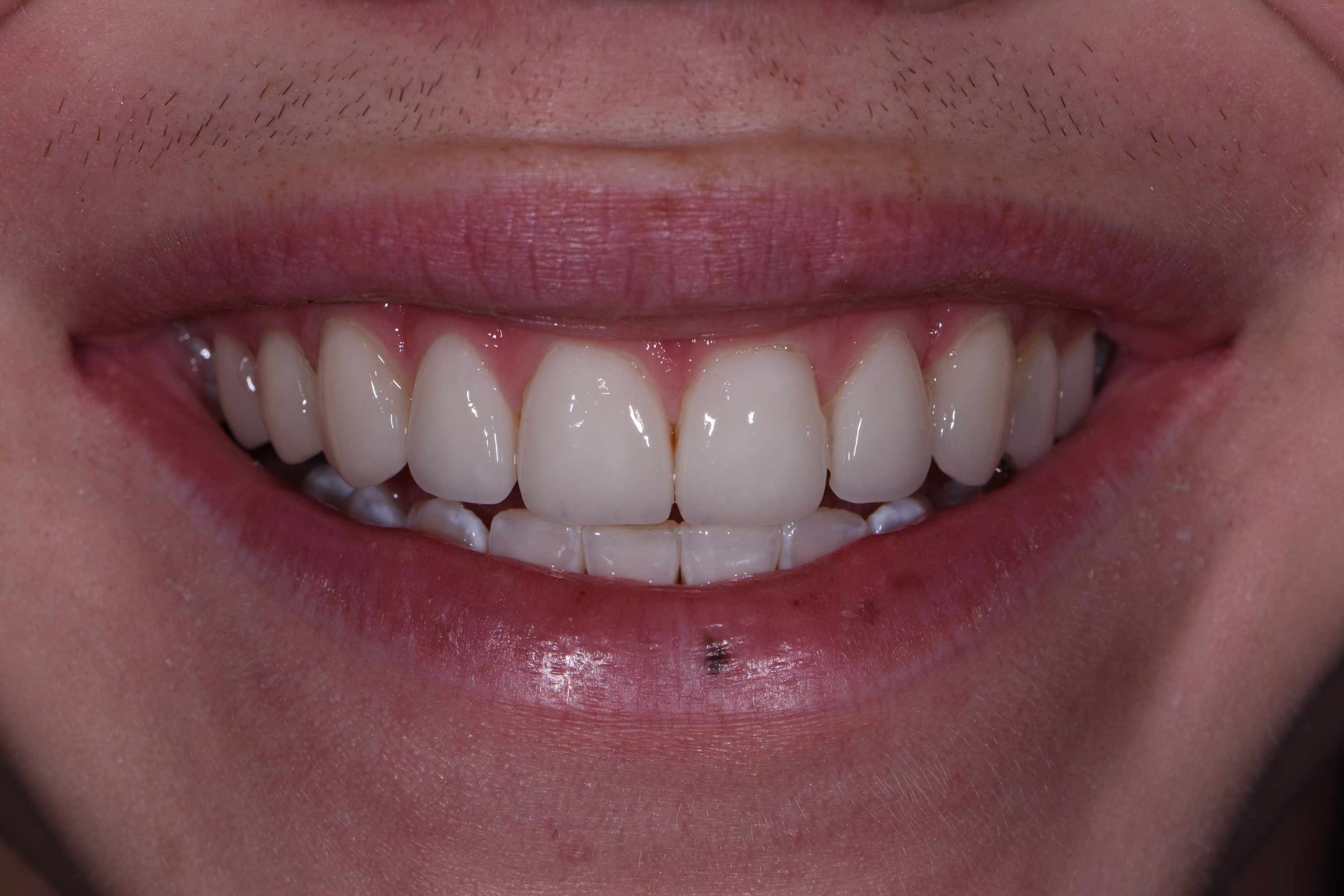 Finesse Dental Care