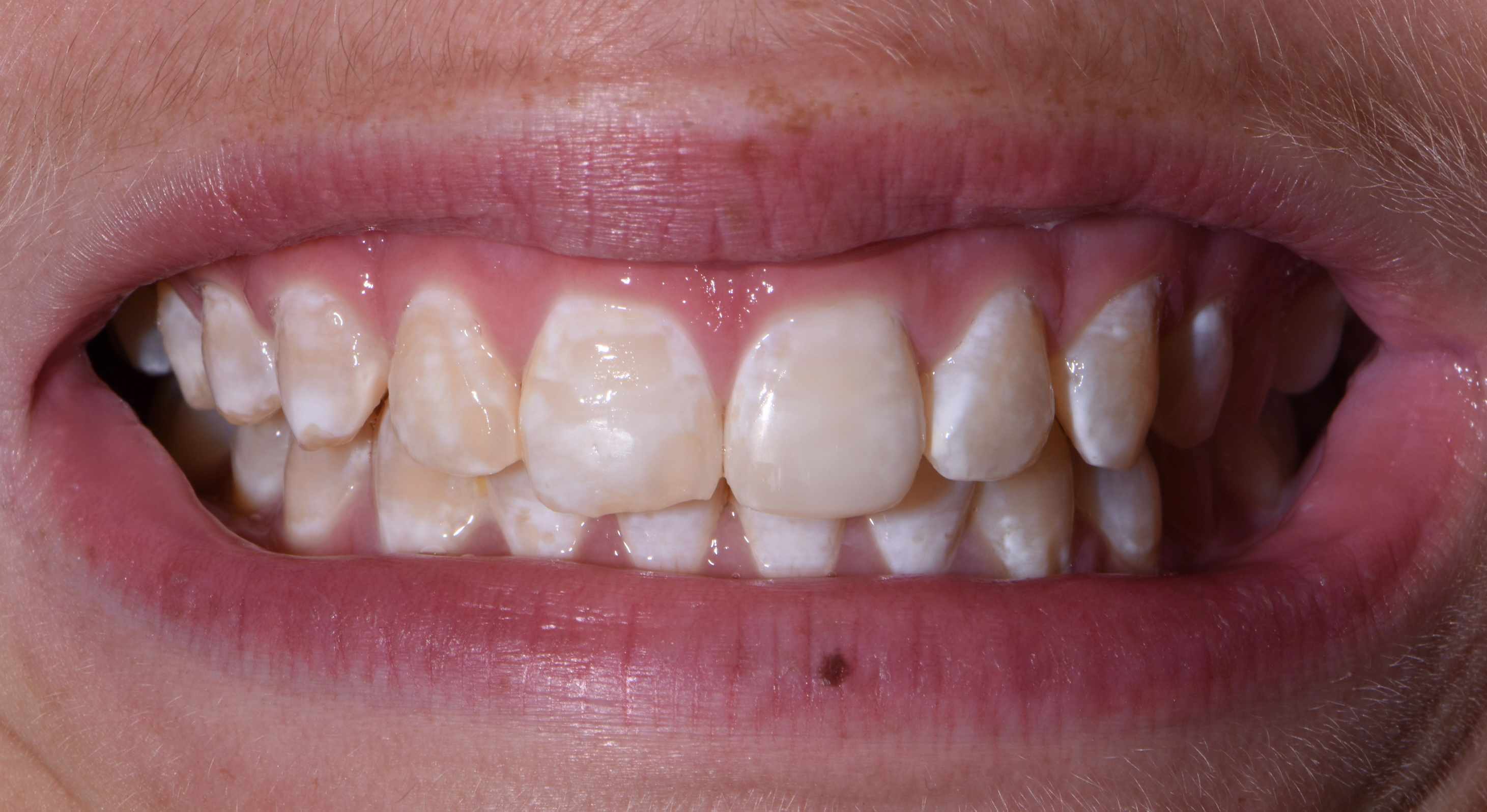 Finesse Dental Care